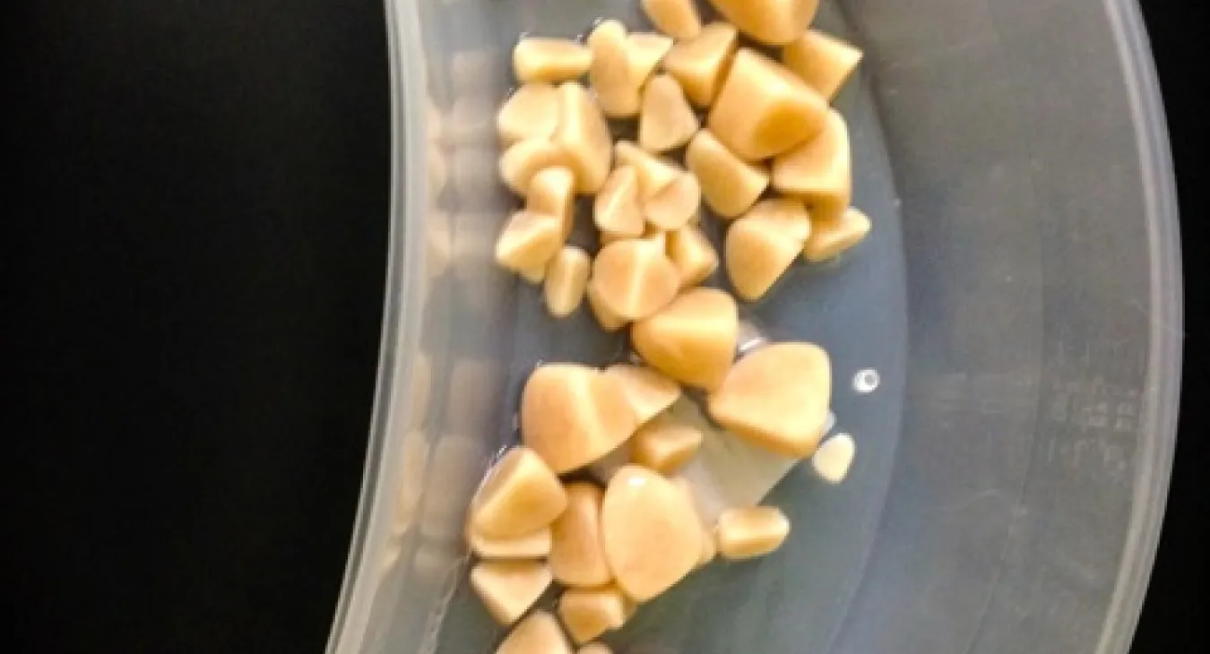 Bladder stones