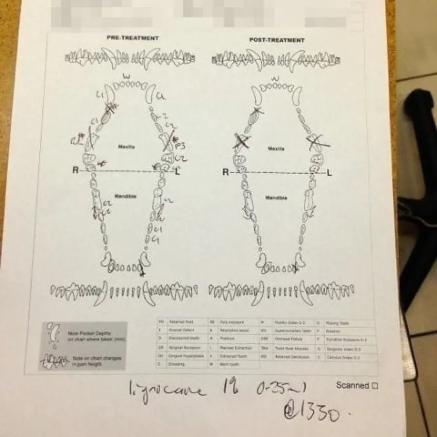 dental chart