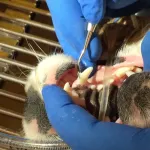 composite being applied to fill the tooth